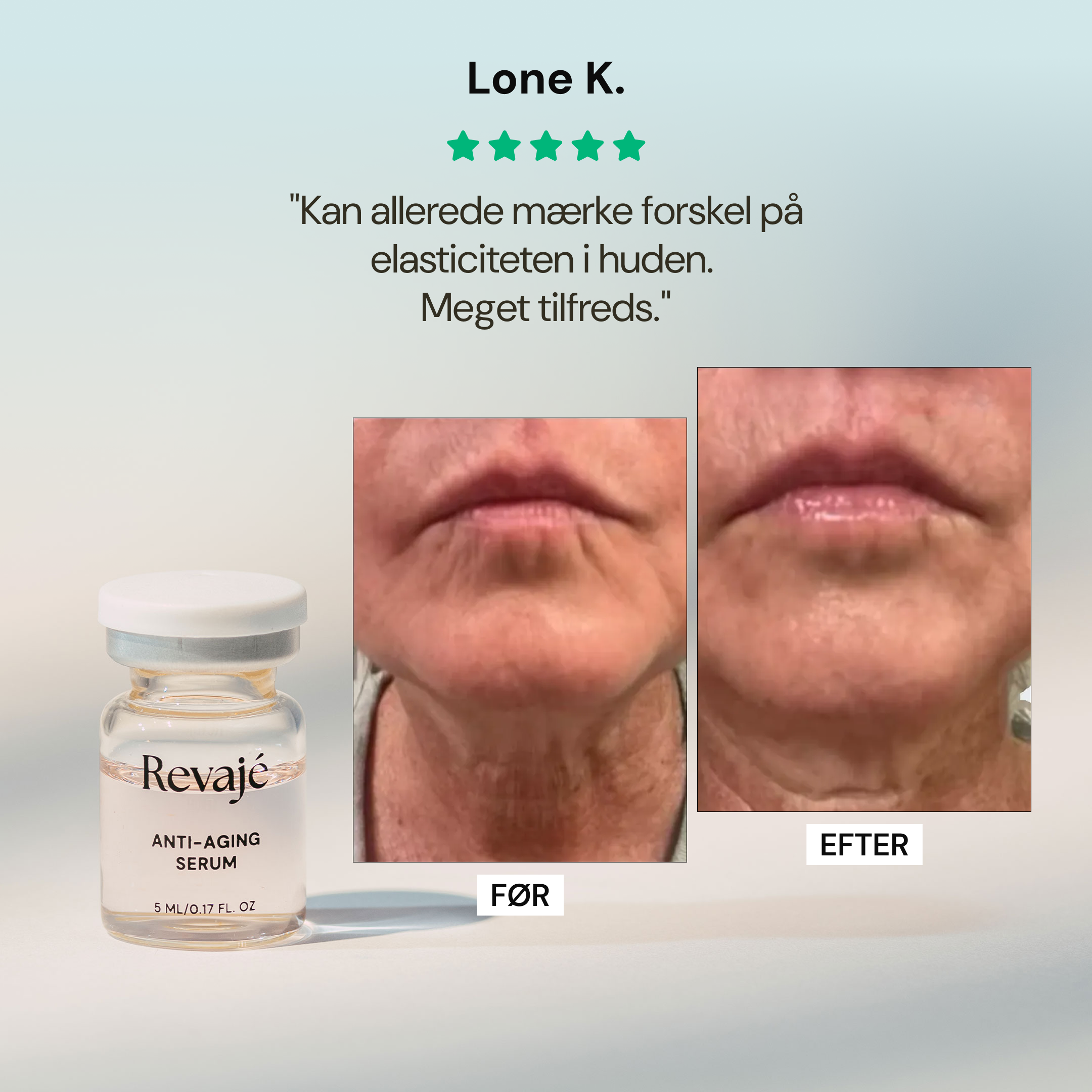 Revaje Microneedling System™