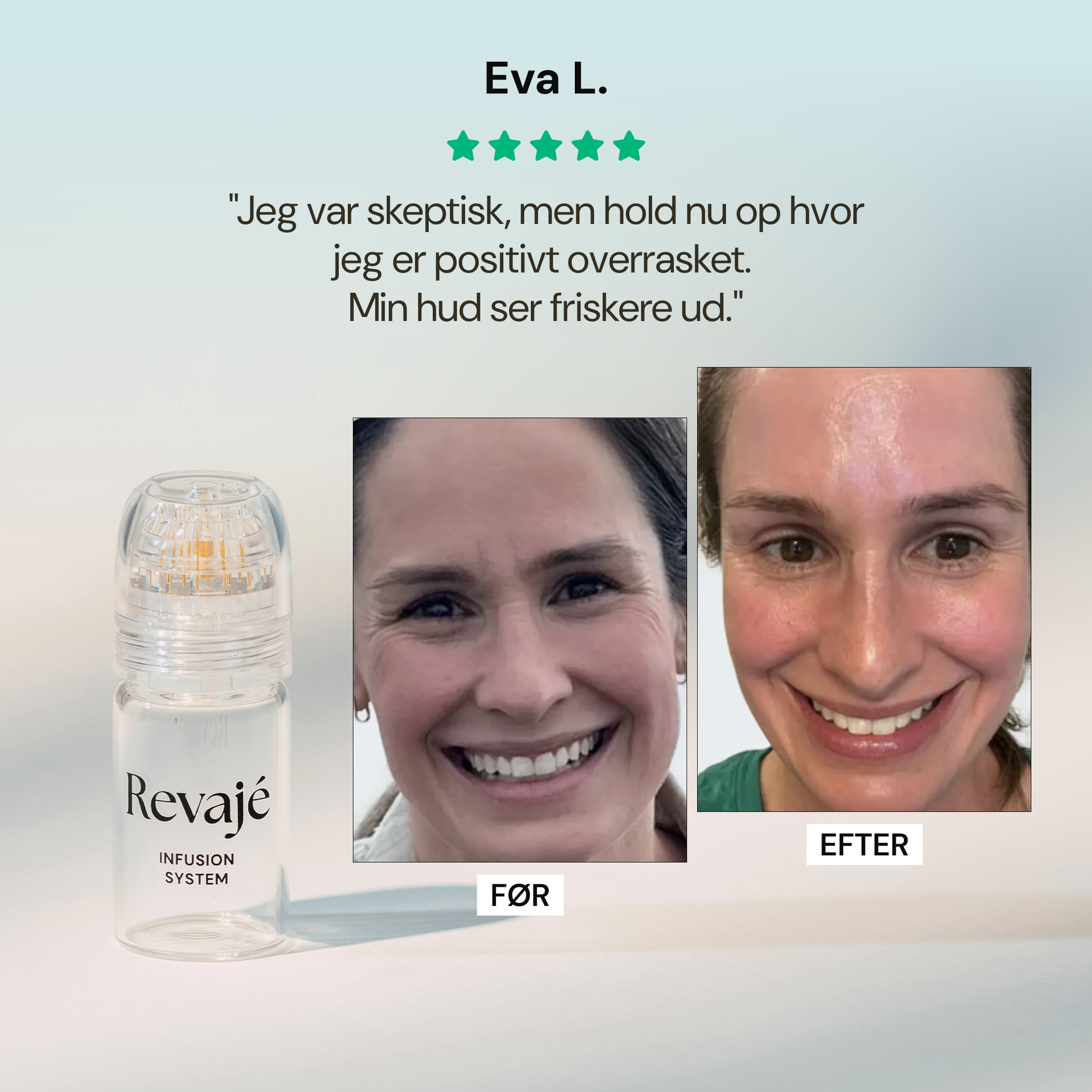 Revaje Microneedling System™